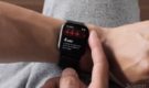 У европейцев появилась функция ЭКГ в Apple Watch (3 фото)